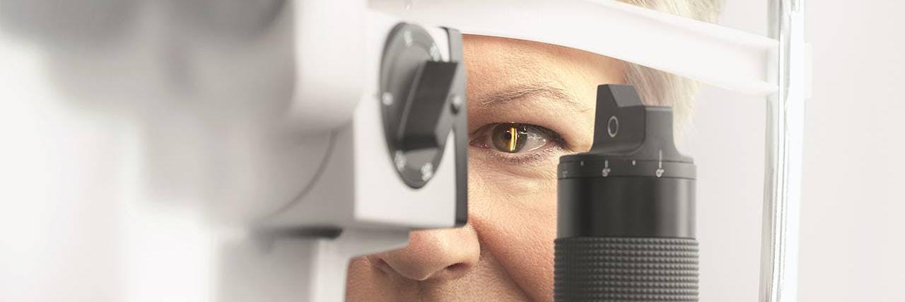 スリットランプの世界