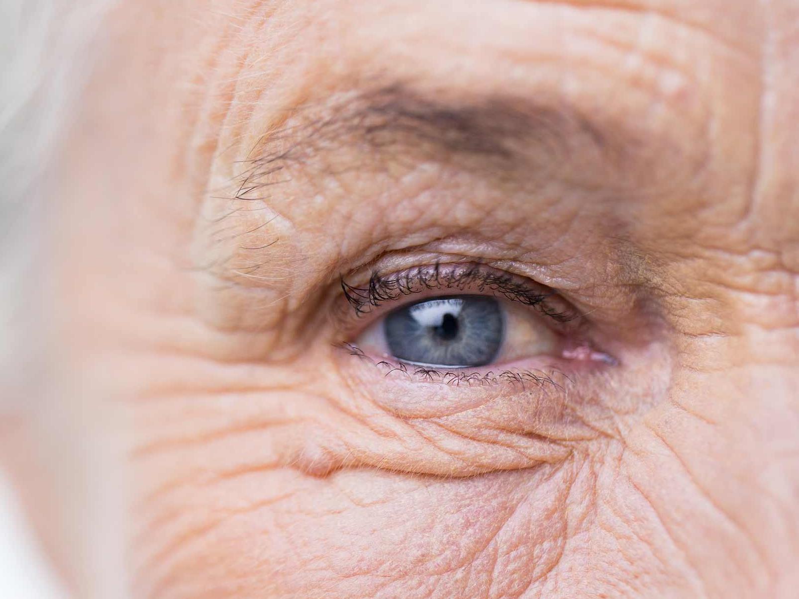 画像は、目の付属器官への危険の可能性を示す、不健康な目のクローズアップです。 