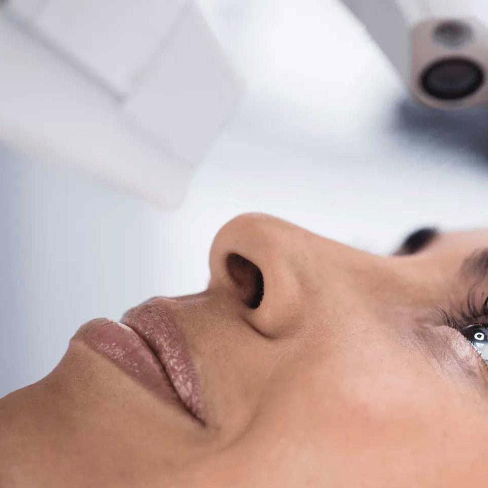 zeiss-smile-procedure.jpg