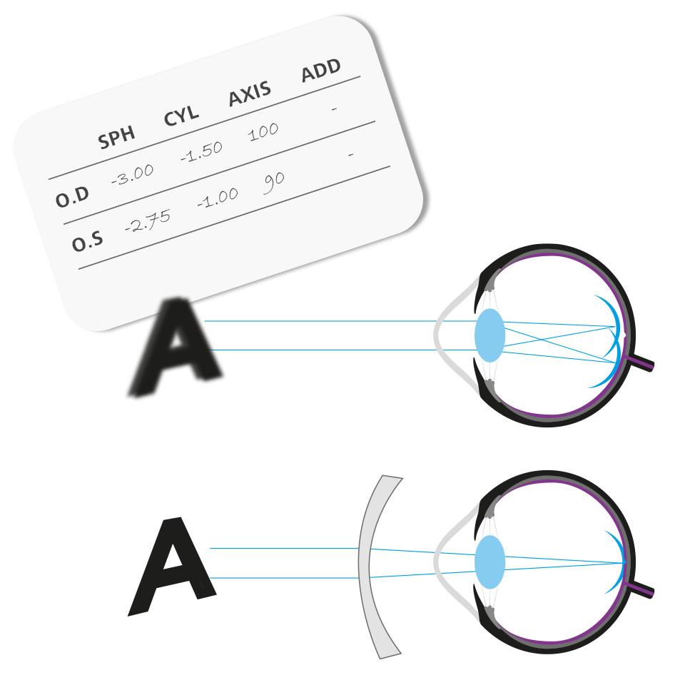 CYLとAXISの列に数字が書かれた処方箋