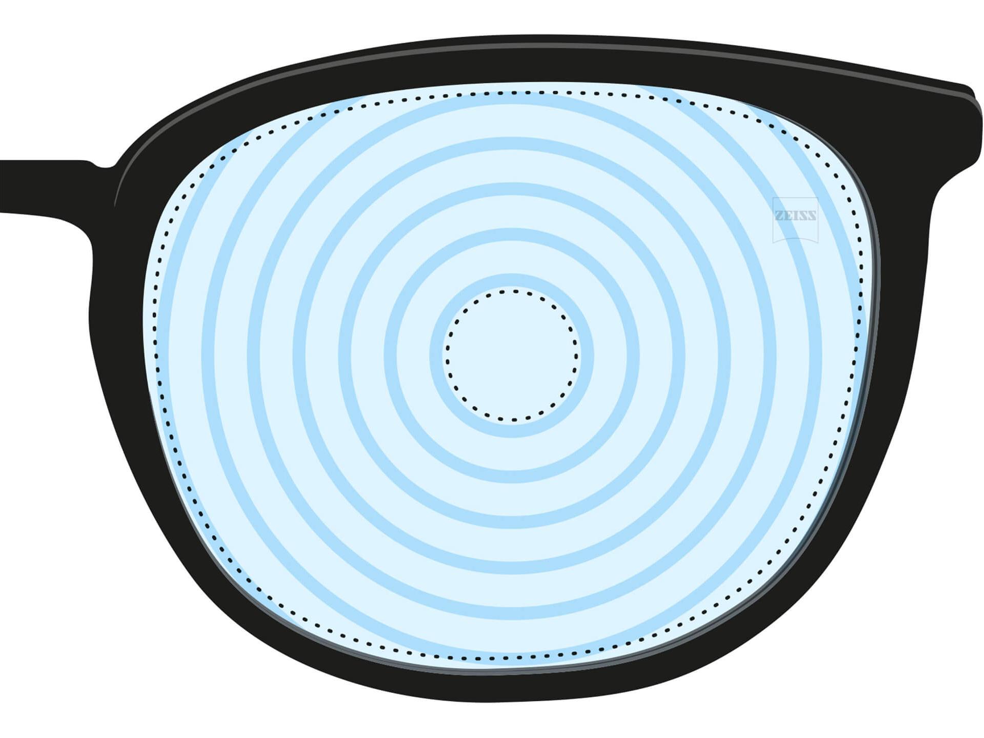 近視ケアをするメガネレンズのイラスト。このレンズには、異なるレンズ強度を示す、同心円があります。これは、特殊な目的のために設計したレンズの一例です。