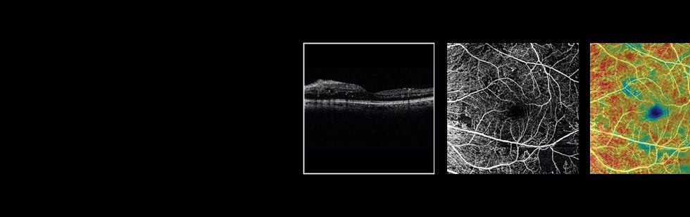CIRRUS with AngioPlex OCT Angiography